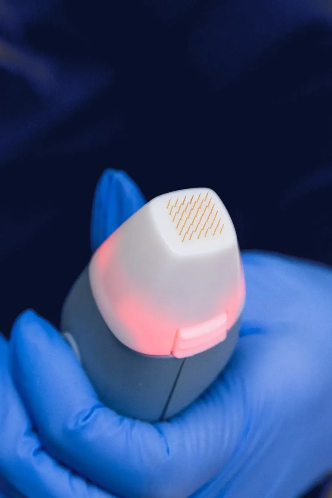 Close view of uneven skin texture and visible pores before RF microneedling at Williamson Aesthetics & Wellness