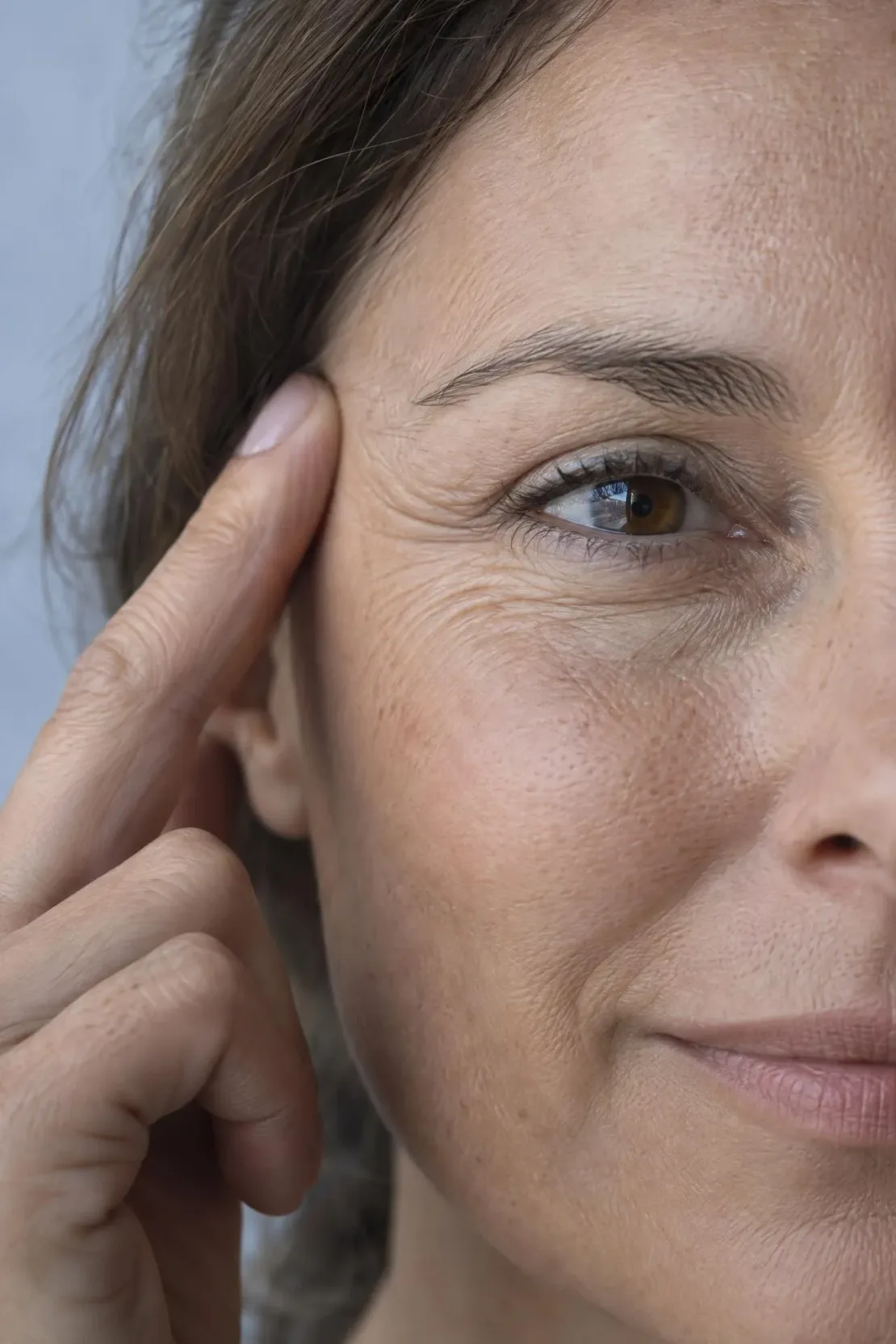 Close view of fine lines around the eyes and forehead reviewed during a consultation at Williamson Aesthetics & Wellness